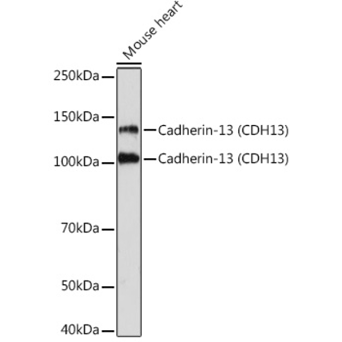 Cadherin-13 (CDH13) Rabbit Monoclonal Antibody