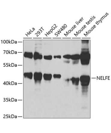 NELFE Rabbit Polyclonal Antibody