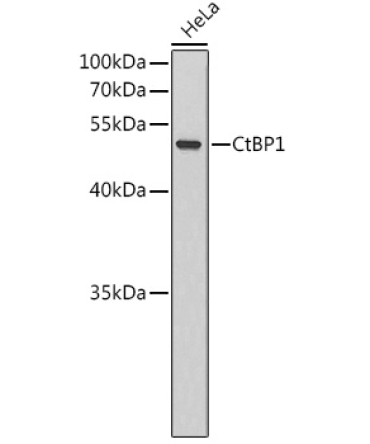 CtBP1 Rabbit Polyclonal Antibody