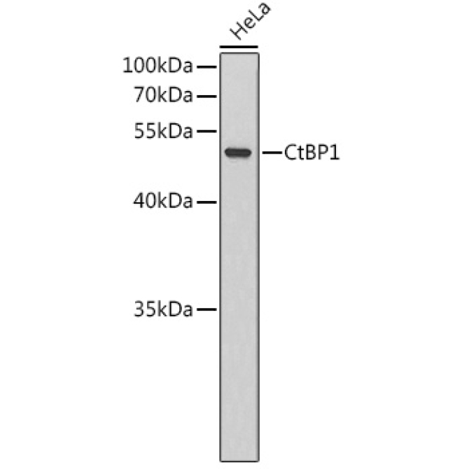 CtBP1 Rabbit Polyclonal Antibody