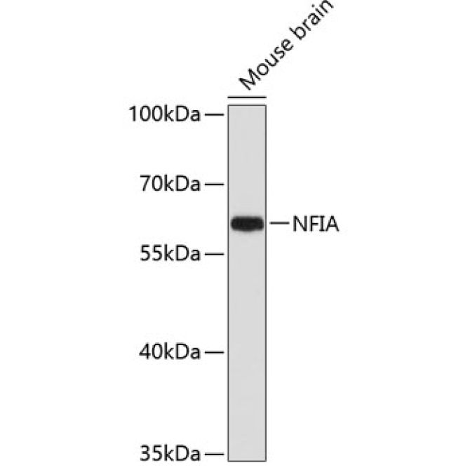 NFIA Rabbit Polyclonal Antibody