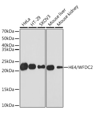 HE4/WFDC2 Rabbit Monoclonal Antibody