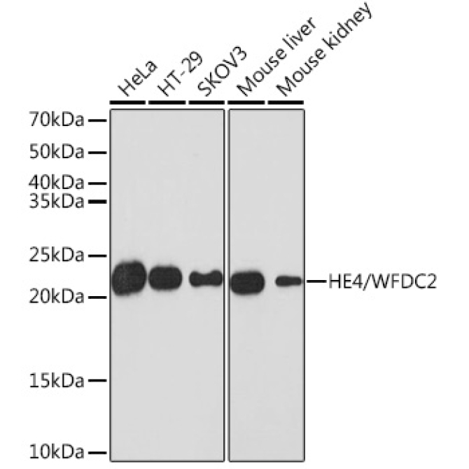 HE4/WFDC2 Rabbit Monoclonal Antibody