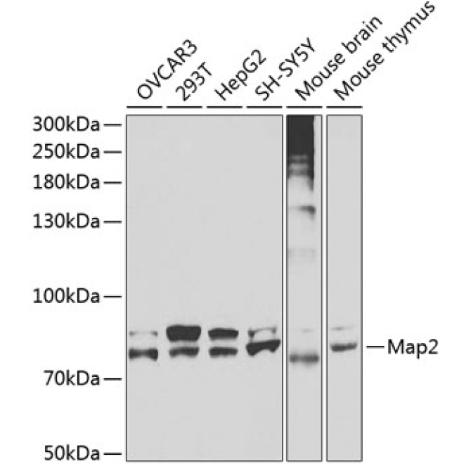 Map2 Rabbit Polyclonal Antibody