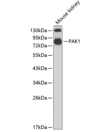 PAK1 Rabbit Polyclonal Antibody