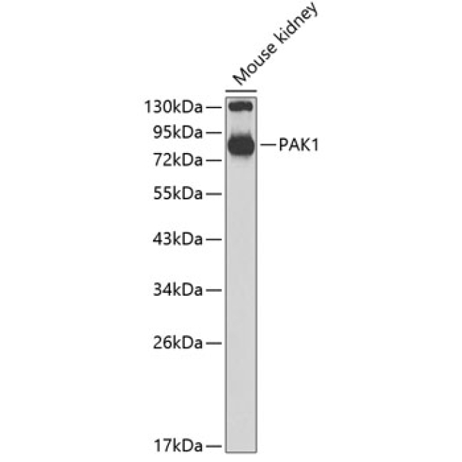 PAK1 Rabbit Polyclonal Antibody