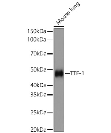 NKX2-1 Rabbit Monoclonal Antibody