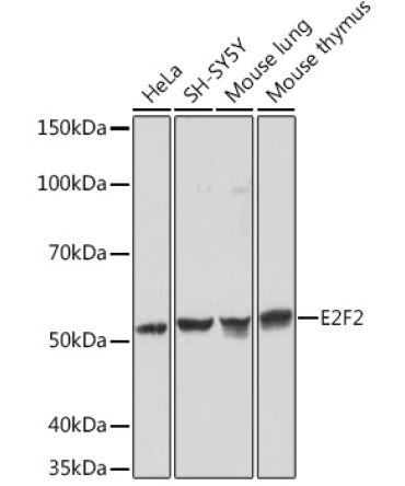 E2F2 Rabbit Monoclonal Antibody