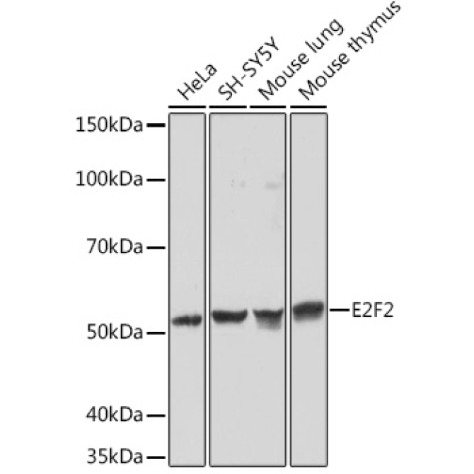 E2F2 Rabbit Monoclonal Antibody