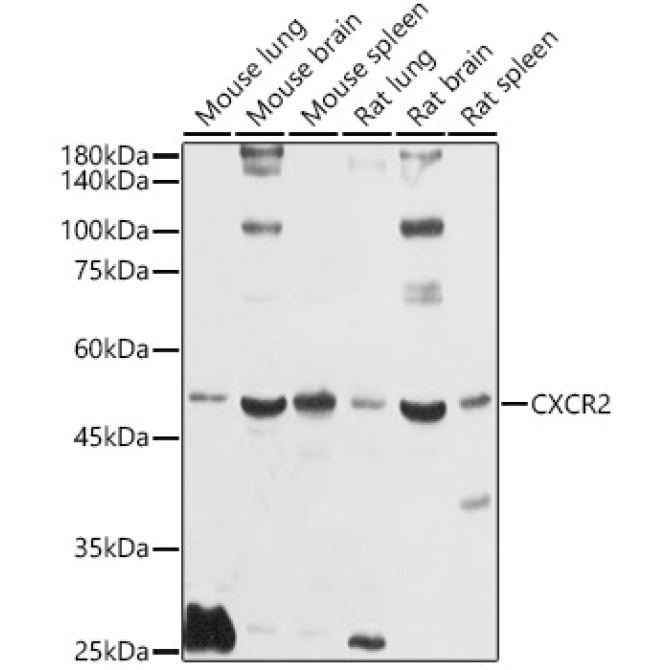 CXCR2 Rabbit Polyclonal Antibody
