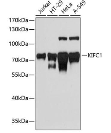 KIFC1 Rabbit Polyclonal Antibody