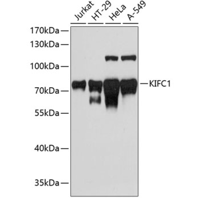 KIFC1 Rabbit Polyclonal Antibody