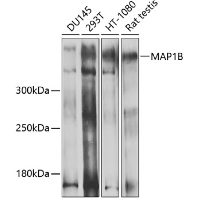 MAP1B Rabbit Polyclonal Antibody