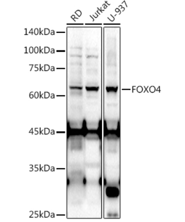 FOXO4 Rabbit Polyclonal Antibody