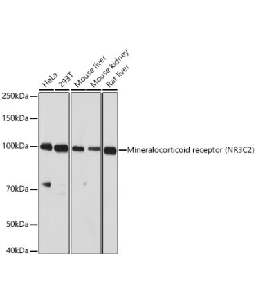 Mineralocorticoid receptor (NR3C2) Rabbit Polyclonal Antibody