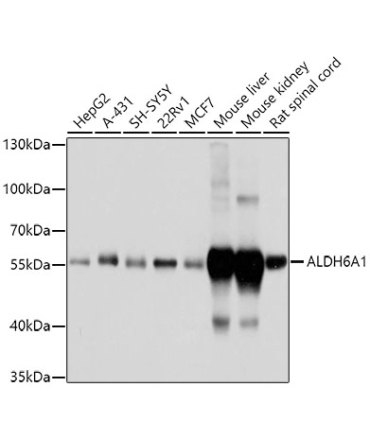 ALDH6A1 Rabbit Polyclonal Antibody