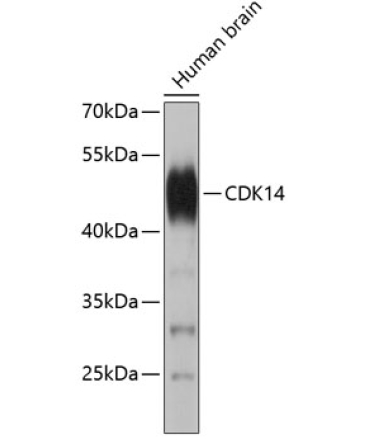 CDK14 Rabbit Polyclonal Antibody