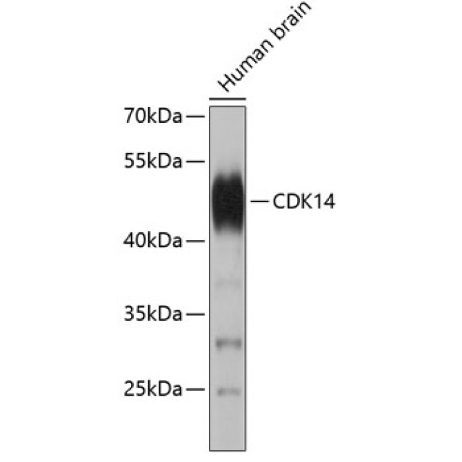 CDK14 Rabbit Polyclonal Antibody