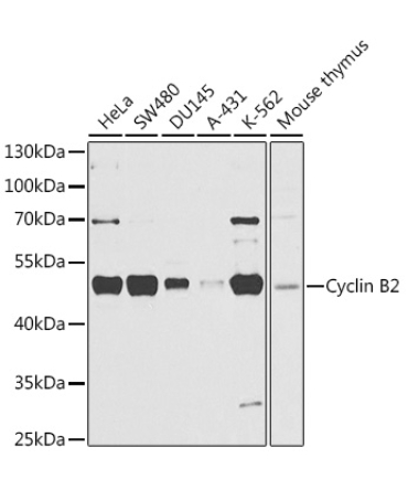 Cyclin B2 Rabbit Polyclonal Antibody