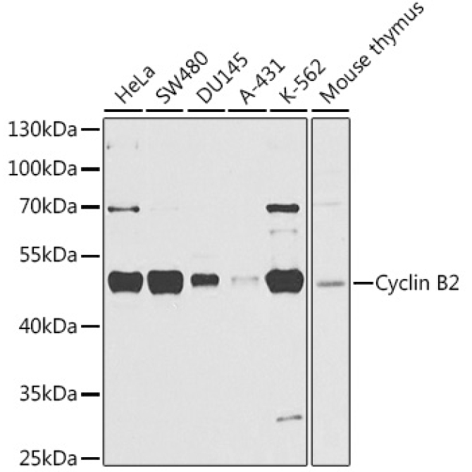 Cyclin B2 Rabbit Polyclonal Antibody