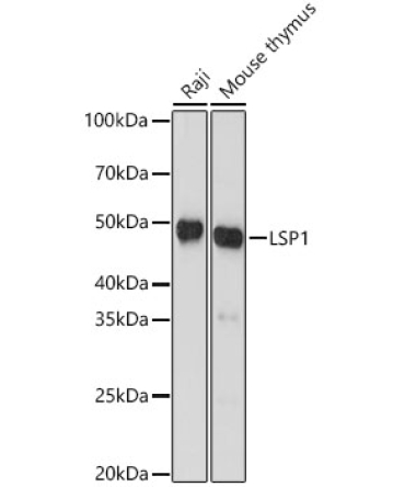 LSP1 Rabbit Monoclonal Antibody