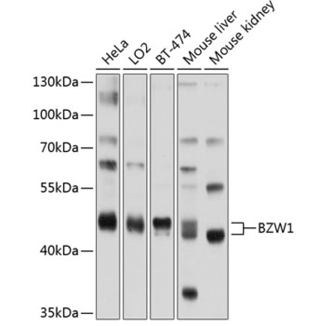 BZW1 Rabbit Polyclonal Antibody