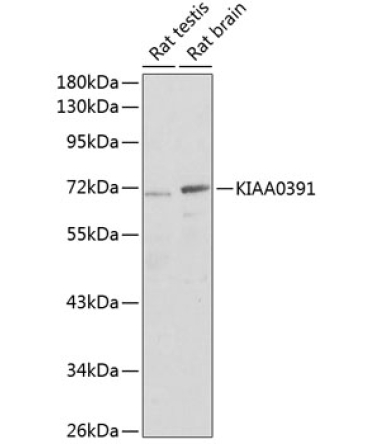KIAA0391 Rabbit Polyclonal Antibody
