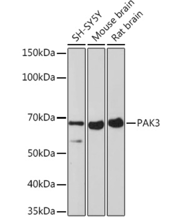 PAK3 Rabbit Monoclonal Antibody