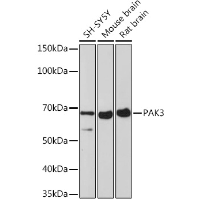 PAK3 Rabbit Monoclonal Antibody