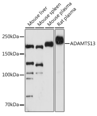 ADAMTS13 Rabbit Monoclonal Antibody