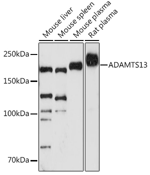 ADAMTS13 Rabbit Monoclonal Antibody