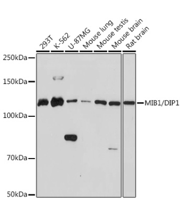 MIB1/DIP1 Rabbit Monoclonal Antibody