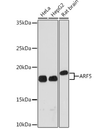 ARF5 Rabbit Monoclonal Antibody
