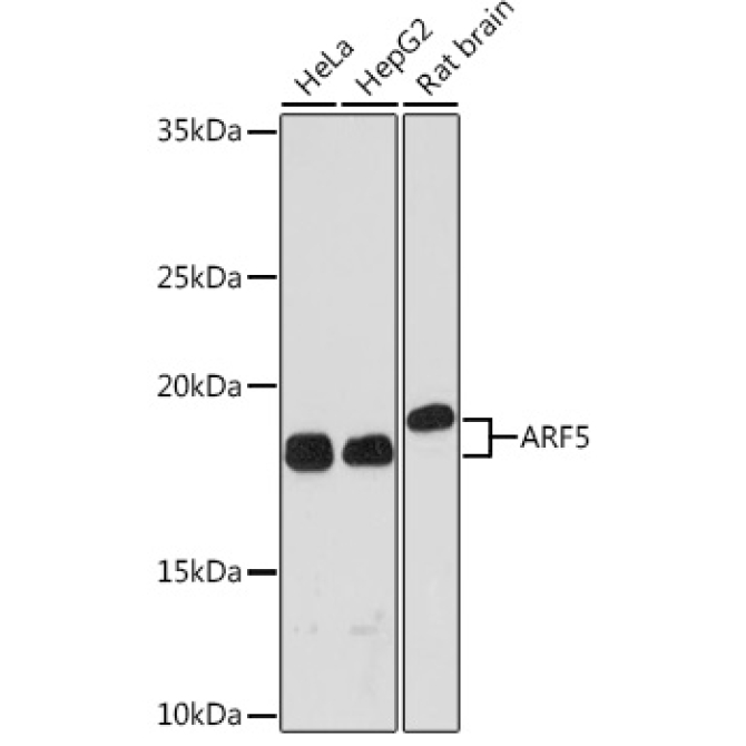 ARF5 Rabbit Monoclonal Antibody