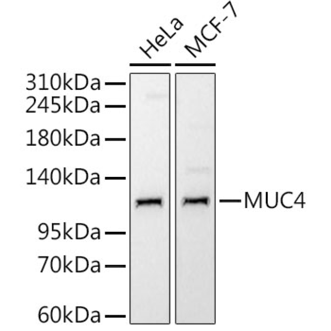 MUC4 Rabbit Monoclonal Antibody