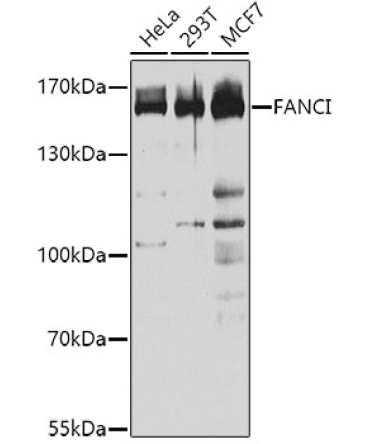 FANCI Rabbit Polyclonal Antibody
