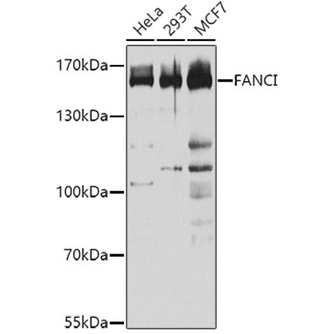 FANCI Rabbit Polyclonal Antibody