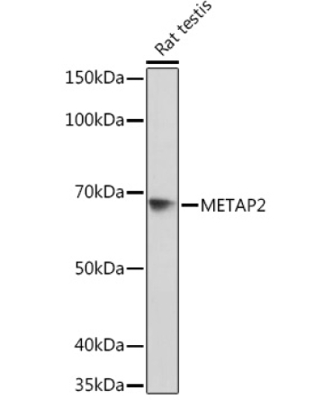 METAP2 Rabbit Monoclonal Antibody