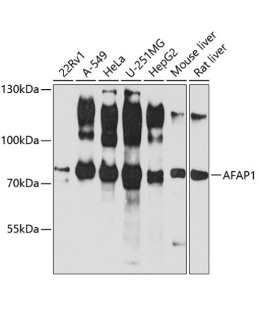 AFAP1 Rabbit Polyclonal Antibody