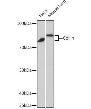 Coilin Rabbit Monoclonal Antibody