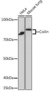 Coilin Rabbit Monoclonal Antibody