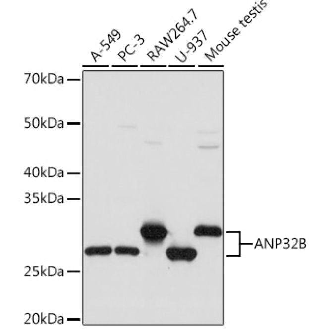 ANP32B Rabbit Monoclonal Antibody
