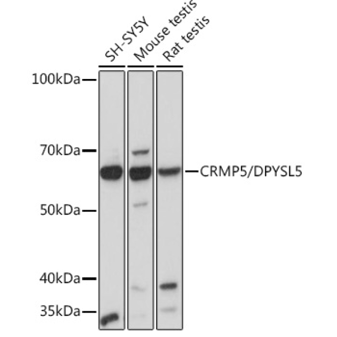 CRMP5/DPYSL5 Rabbit Monoclonal Antibody