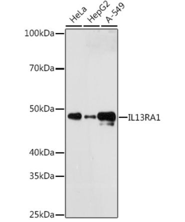 IL13RA1 Rabbit Monoclonal Antibody