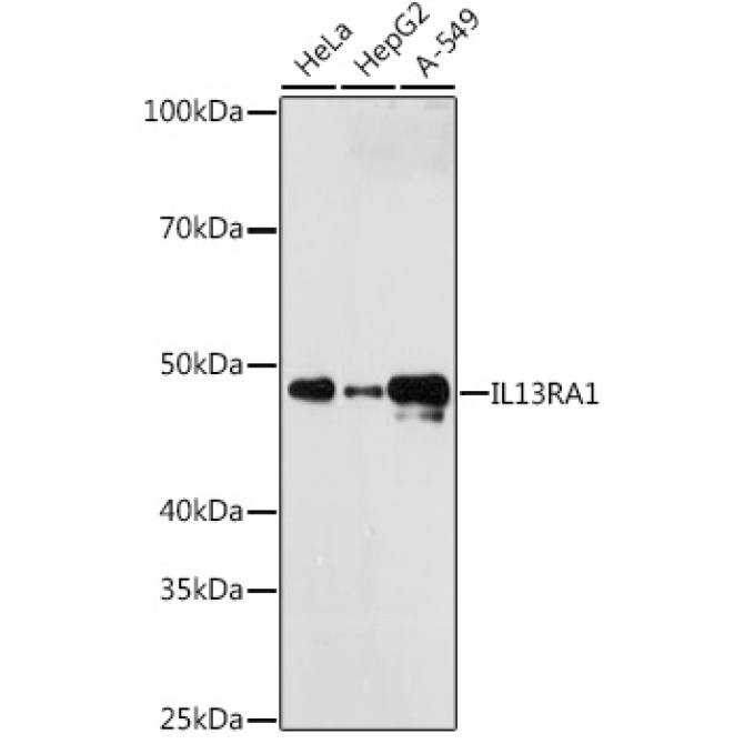 IL13RA1 Rabbit Monoclonal Antibody