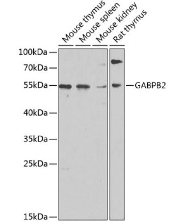 GABPB2 Rabbit Polyclonal Antibody