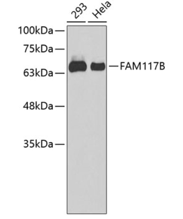 FAM117B Rabbit Polyclonal Antibody