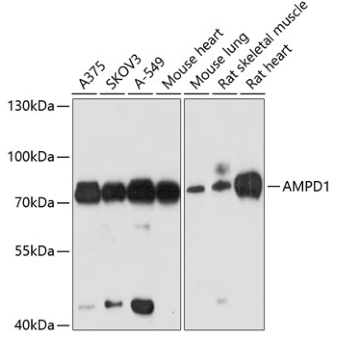 AMPD1 Rabbit Polyclonal Antibody