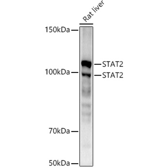 STAT2 Rabbit Monoclonal Antibody [KD Validated]