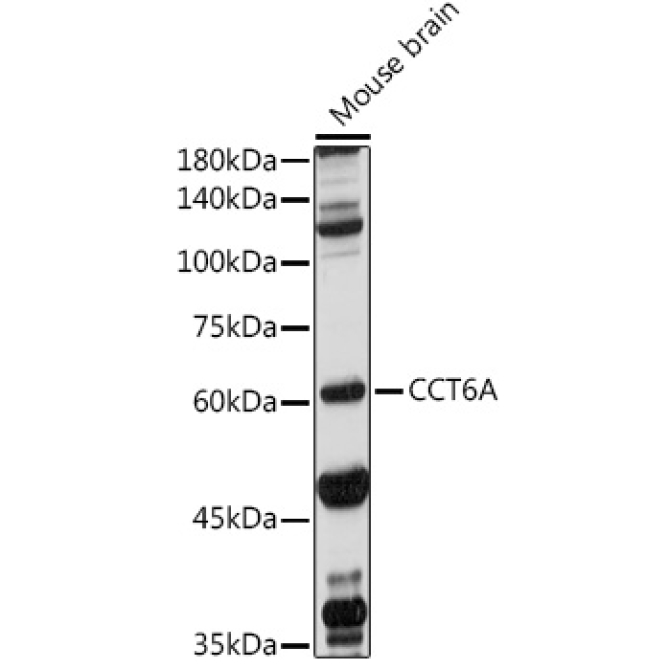 CCT6A Rabbit Polyclonal Antibody